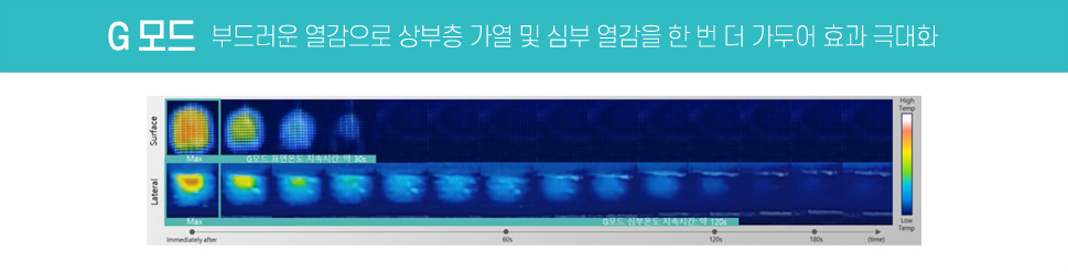 동탄 올리지오X G모드 글라이딩 스탬핑 시술 이미지