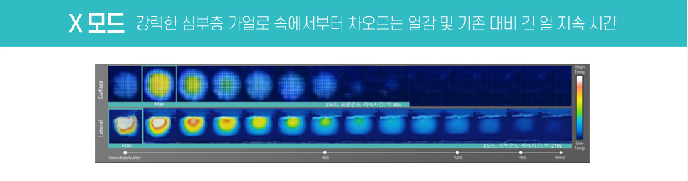 동탄 올리지오X X모드 심부 타이트닝 정교 시술 이미지